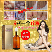 3pc Fungal Nail Treatment TCM Essence Oil Hand and Foot Whitening Toe Nail Fungus Removal Feet
