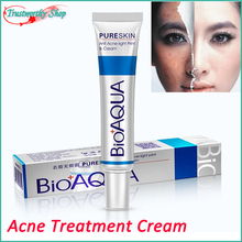 acne treatment cream scar removal oily skin Acne Spots skin care face stretch marks maquillage makeup free shipping