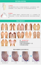 New arrival 1pair Foot Health Gel Bunion Protector Toe Straightener Spreader Correctors Hallux Valgus Feet Care