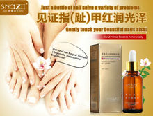 SnazII Fungal Nail Treatment Essence Nail and Foot Whitening Toe Nail Fungus Profession Removal Feet Care