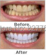 2pcs Free Shipping Popular White Teeth Whitening Pen Tooth Gel Whitener Bleach Remove Stains