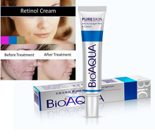 Beauty Face Anti Acne Light Print Scar Removal Cream Acne Spots Pure Skin Care Treatment Whitening
