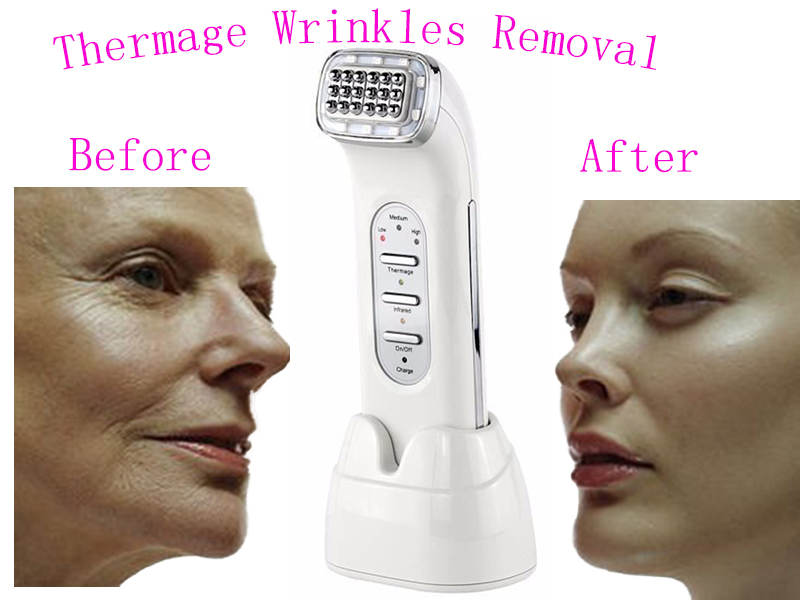 New RF Radio Frequency Skin Face Care Lifting Tightening Wrinkle Removal Facial Physical Massage Machine 100-240V Rechargeable
