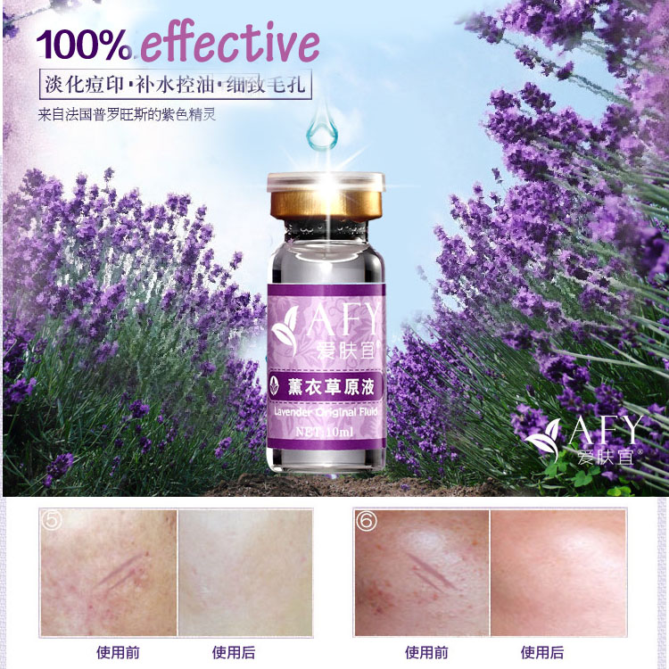 New Face Lavender Repair Serum 10ml Skin Treatment Care Remove Scar Cream Remove Acne Spots Whitening