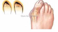 3 Pair Feet Care Hallux Valgus Braces Orthotics Cloven Toe Separator Corrective Insoles Toes Pedicure Device