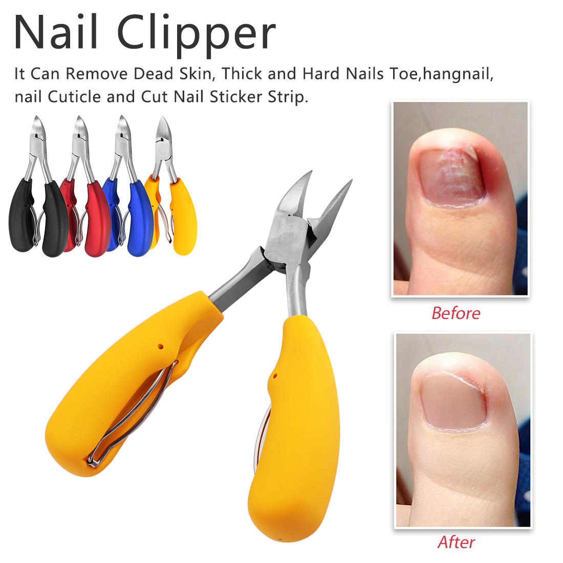 nail clippers for ingrown nail