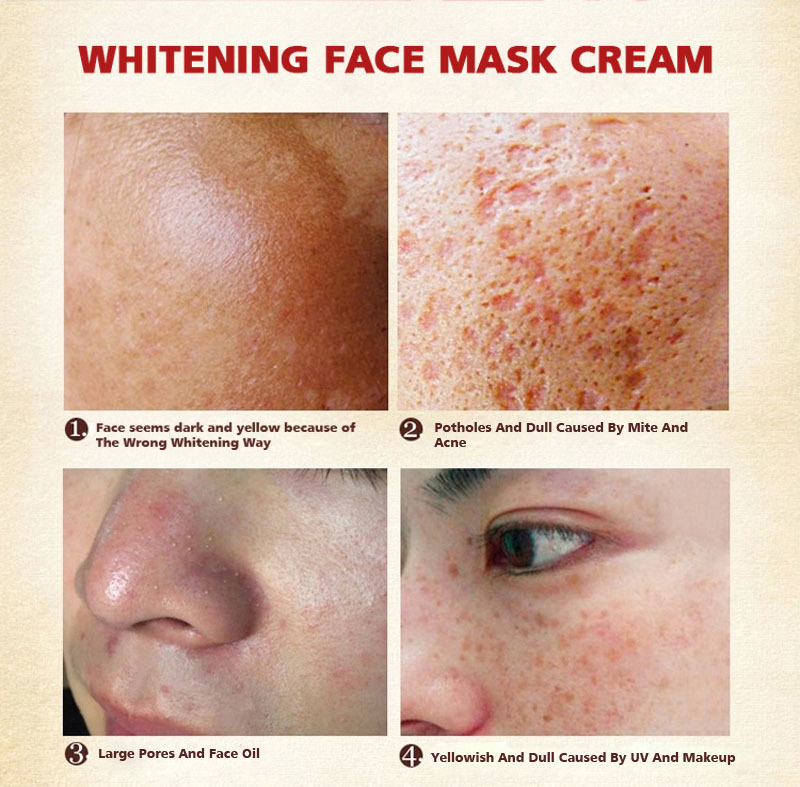 Facial Skin Spots 83