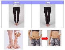 1Pairs New magnet lose weight new technology healthy slim loss toe ring sticker silicon foot massage
