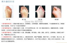 2Pair Free shipping 2014 New Hotsale Beetle crusher Bone Ectropion Toes outer Appliance Professional Health Care