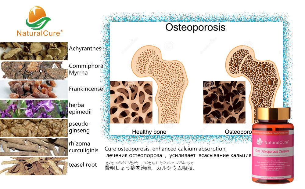 Como mejorar la osteoporosis