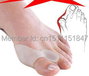 20Pairs 2014 New Hot Sale Beetle crusher Bone Ectropion Toes Outer Appliance Professional Technology Health Care