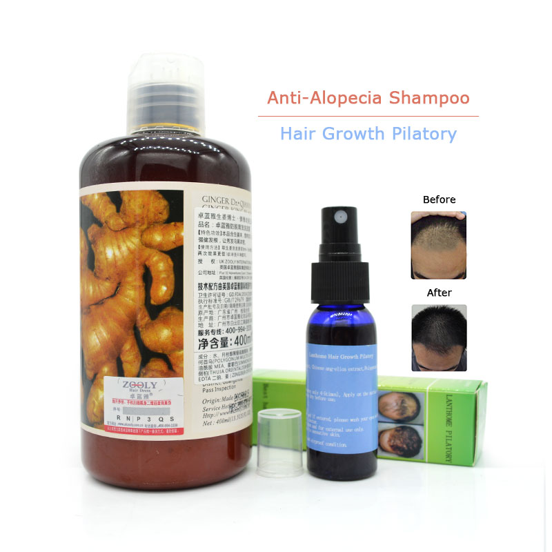 ginger as hair loss treatment ginger as hair loss treatment