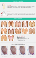 Free shipping Best selling Beetle crusher Bone Ectropion silicone orthoses Professional Health Care massage 10pair lot