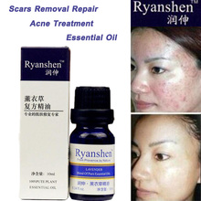 Face Care Ryanshen Remove Scar Repair Oil Acne Treatment Remove Freckle Scar Spots Stretch Marks Repair