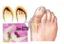 New Hotsale Beetle crusher Bone Ectropion Toes outer Appliance Professional Technology Health Care Products without box