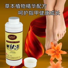 Du master A net herbal essence skin except onychomycosis onychomycosis nail concentrate efficient repair solution