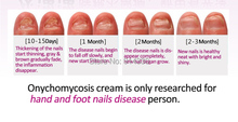 4packs Nail fungus treatment nail disease Onychomycosis fungal toenail finger nail care