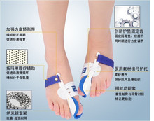 Hot Beetle crusher Bone Ectropion Toes outer Appliance Professional Technology Health Care Product left and right