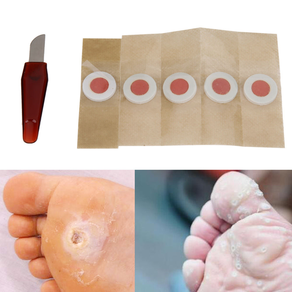 5pcs/pack Medical Plaster Corn Plantar Calluse Removal Foot Care Stickers Patch For Relieving Pain Health Care 5pcs/pack Medical Plaster Corn Plantar Calluse Removal Foot Care Stickers Patch For Relieving Pain Health Care 5pcs/pack Medical Plaster Corn Plantar Calluse Removal Foot Care Stickers Patch For Relieving Pain Health Care 5pcs/pack Medical Plaster Corn Plantar Calluse Removal Foot Care Stickers Patch For Relieving Pain Health Care