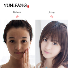 face care YUNIFANG Face Cream Face Skin Care Treatment Moisturizing Whitening Anti Winkles Aging Cream free